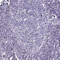 Invitrogen DCI Polyclonal Antibody 100 &mu;L; Unconjugated:Antibodies,