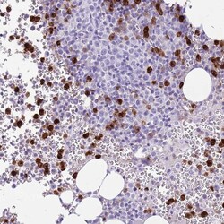 Invitrogen CD177 Polyclonal Antibody 100 &mu;L; Unconjugated:Antibodies,