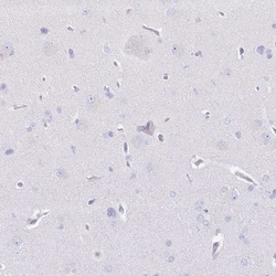 Invitrogen CD177 Polyclonal Antibody 100 &mu;L; Unconjugated:Antibodies,