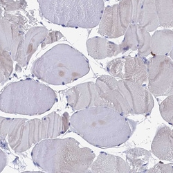 Invitrogen TYROBP Polyclonal Antibody 100 &mu;L | Buy Online | Invitrogen&trade; | Fisher Scientific