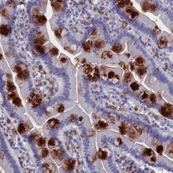 Invitrogen TYROBP Polyclonal Antibody 100 &mu;L | Buy Online | Invitrogen&trade; | Fisher Scientific