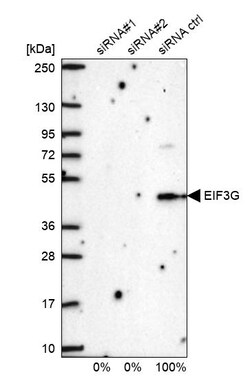 Invitrogen eIF3g Polyclonal Antibody 100 &mu;L; Unconjugated:Antibodies,