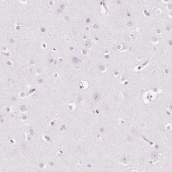 Invitrogen EHHADH Polyclonal Antibody 100 &mu;L; Unconjugated:Antibodies,