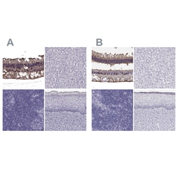 Invitrogen CRALBP Polyclonal Antibody 100 &mu;L; Unconjugated:Antibodies,
