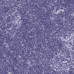 Invitrogen CRALBP Polyclonal Antibody 100 &mu;L; Unconjugated:Antibodies,