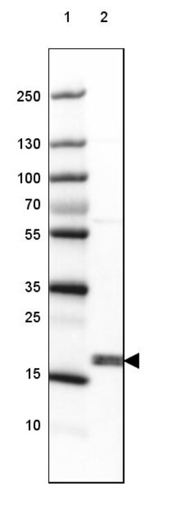 Invitrogen CPI-17 Polyclonal Antibody 100 &mu;L | Buy Online | Invitrogen&trade; | Fisher Scientific