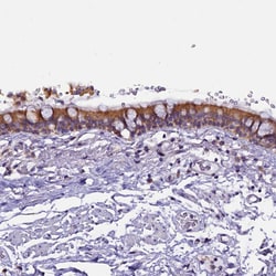 Invitrogen CEP170 Polyclonal Antibody 100 &mu;L; Unconjugated:Antibodies,