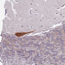 Invitrogen p130Cas Polyclonal Antibody 100 &mu;L; Unconjugated:Antibodies,