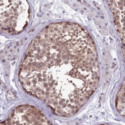 Invitrogen p130Cas Polyclonal Antibody 100 &mu;L; Unconjugated:Antibodies,