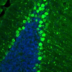 Invitrogen p130Cas Polyclonal Antibody 100 &mu;L; Unconjugated:Antibodies,