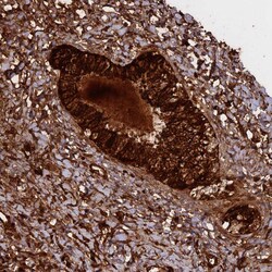 Invitrogen WFDC2 Polyclonal Antibody 100 &mu;L; Unconjugated:Antibodies,