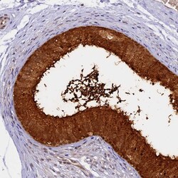 Invitrogen WFDC2 Polyclonal Antibody 100 &mu;L; Unconjugated:Antibodies,