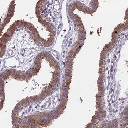 Invitrogen WFDC2 Polyclonal Antibody 100 &mu;L; Unconjugated:Antibodies,