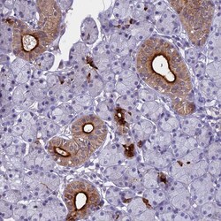 Invitrogen WFDC2 Polyclonal Antibody 100 &mu;L; Unconjugated:Antibodies,
