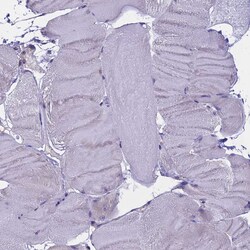 Invitrogen WFDC2 Polyclonal Antibody 100 &mu;L; Unconjugated:Antibodies,