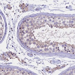 Invitrogen WFDC2 Polyclonal Antibody 100 &mu;L; Unconjugated:Antibodies,