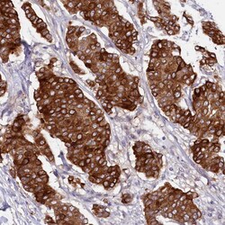 Invitrogen SLC39A6 Polyclonal Antibody 100 &mu;L; Unconjugated:Antibodies,