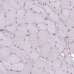 Invitrogen SLC39A6 Polyclonal Antibody 100 &mu;L; Unconjugated:Antibodies,