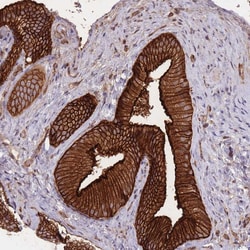 Invitrogen PLD1 Polyclonal Antibody 100 &mu;L; Unconjugated:Antibodies,