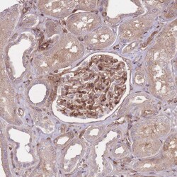 Invitrogen PLD1 Polyclonal Antibody 100 &mu;L; Unconjugated:Antibodies,