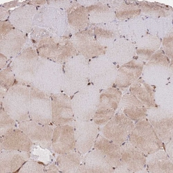 Invitrogen PLD1 Polyclonal Antibody 100 &mu;L; Unconjugated:Antibodies,