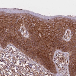 Invitrogen PLD1 Polyclonal Antibody 100 &mu;L; Unconjugated:Antibodies,