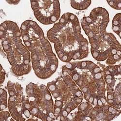 Invitrogen PLD1 Polyclonal Antibody 100 &mu;L; Unconjugated:Antibodies,