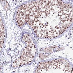 Invitrogen NCBP1 Polyclonal Antibody 100 &mu;L; Unconjugated:Antibodies,