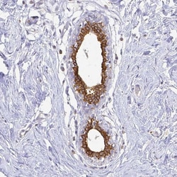 Invitrogen Calmyrin Polyclonal Antibody 100 &mu;L; Unconjugated:Antibodies,