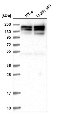 Invitrogen SYMPK Polyclonal Antibody 100 &mu;L; Unconjugated:Antibodies,
