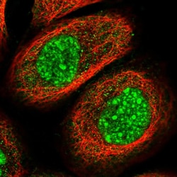Invitrogen SETD2 Polyclonal Antibody 100 &mu;L; Unconjugated:Antibodies,