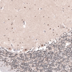 Invitrogen SETD2 Polyclonal Antibody 100 &mu;L; Unconjugated:Antibodies,