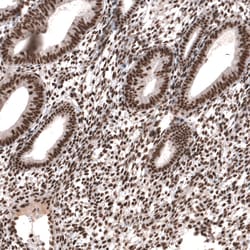 Invitrogen SETD2 Polyclonal Antibody 100 &mu;L; Unconjugated:Antibodies,