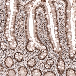 Invitrogen SETD2 Polyclonal Antibody 100 &mu;L; Unconjugated:Antibodies,