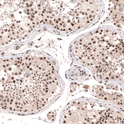 Invitrogen SETD2 Polyclonal Antibody 100 &mu;L; Unconjugated:Antibodies,