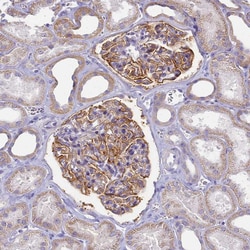 Invitrogen CD35 Polyclonal Antibody 100 &mu;L | Buy Online | Invitrogen&trade; | Fisher Scientific