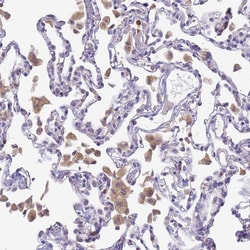 Invitrogen CD35 Polyclonal Antibody 100 &mu;L | Buy Online | Invitrogen&trade; | Fisher Scientific