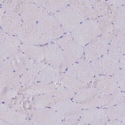 Invitrogen CD35 Polyclonal Antibody 100 &mu;L | Buy Online | Invitrogen&trade; | Fisher Scientific