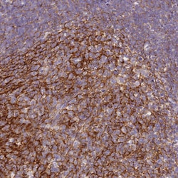 Invitrogen CD35 Polyclonal Antibody 100 &mu;L | Buy Online | Invitrogen&trade; | Fisher Scientific