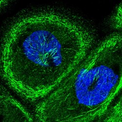 Invitrogen Septin-9 Polyclonal Antibody 100 &mu;L; Unconjugated:Antibodies,