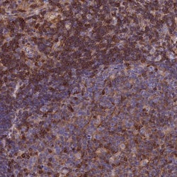 Invitrogen Septin-9 Polyclonal Antibody 100 &mu;L; Unconjugated:Antibodies,