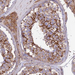 Invitrogen Septin-9 Polyclonal Antibody 100 &mu;L; Unconjugated:Antibodies,