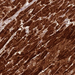 Invitrogen CSRP3 Polyclonal Antibody 100 &mu;L; Unconjugated:Antibodies,