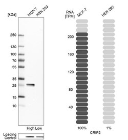 Invitrogen CRIP2 Polyclonal Antibody 100 &mu;L | Buy Online | Invitrogen&trade; | Fisher Scientific