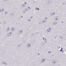 Invitrogen WFDC8 Polyclonal Antibody 100 &mu;L; Unconjugated:Antibodies,