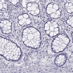 Invitrogen WFDC8 Polyclonal Antibody 100 &mu;L; Unconjugated:Antibodies,