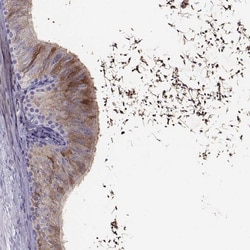 Invitrogen WFDC8 Polyclonal Antibody 100 &mu;L; Unconjugated:Antibodies,