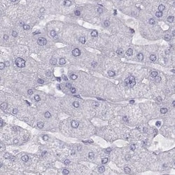 Invitrogen WFDC8 Polyclonal Antibody 100 &mu;L; Unconjugated:Antibodies,
