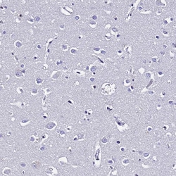 Invitrogen S100A11 Polyclonal Antibody 100 &mu;L; Unconjugated:Antibodies,