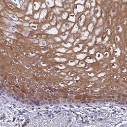 Invitrogen S100A11 Polyclonal Antibody 100 &mu;L; Unconjugated:Antibodies,